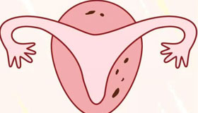 女方子宮內膜